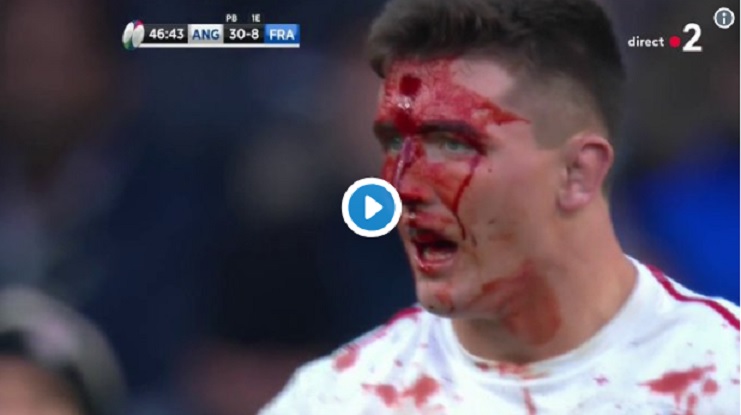 VIDEO: L’impressionnante blessure au visage de l’Anglais Tom Curry contre les Bleus