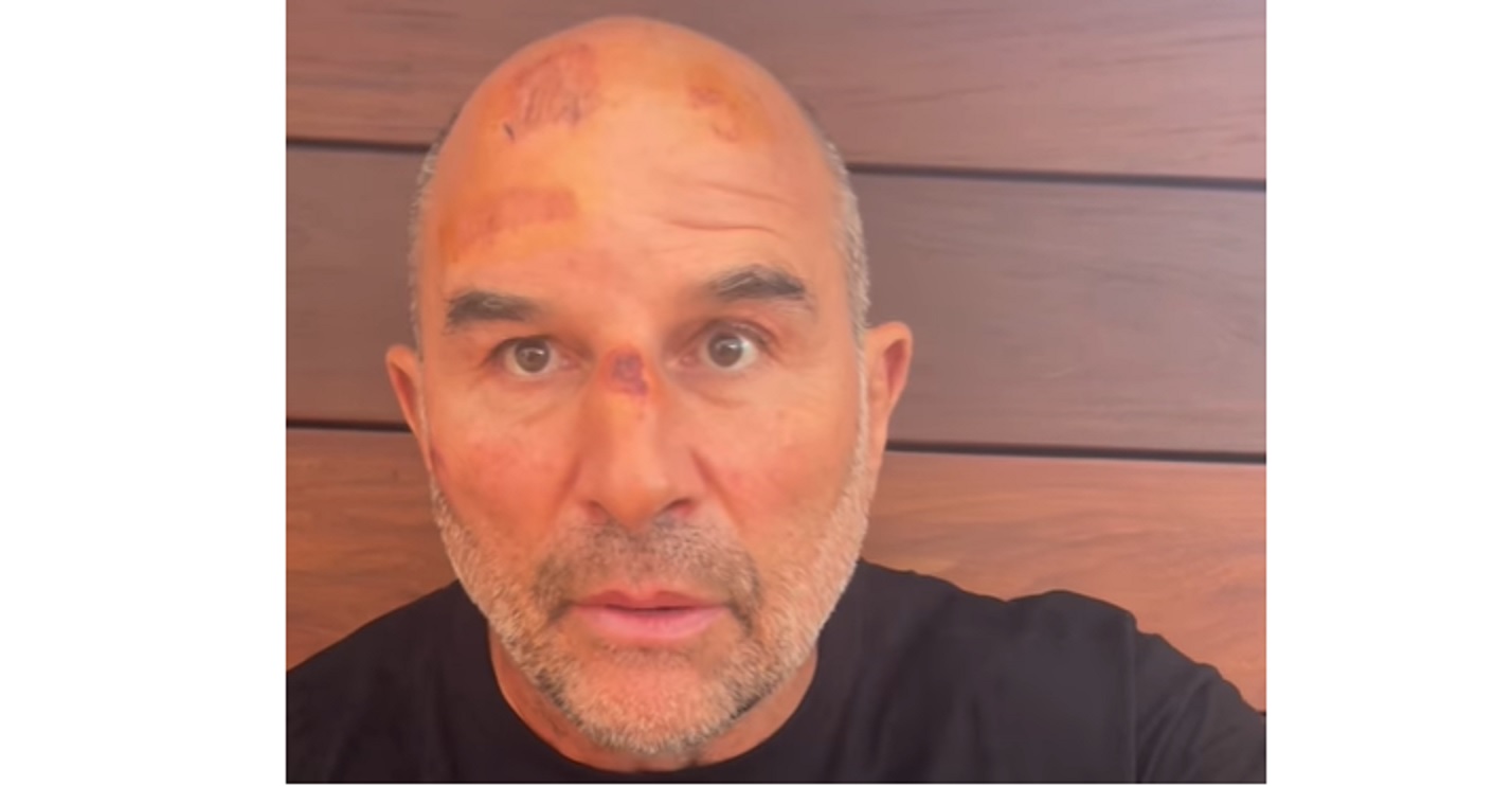 VIDEO – Vincent Moscato dévisagé : Il explique ce qui lui est arrivé !