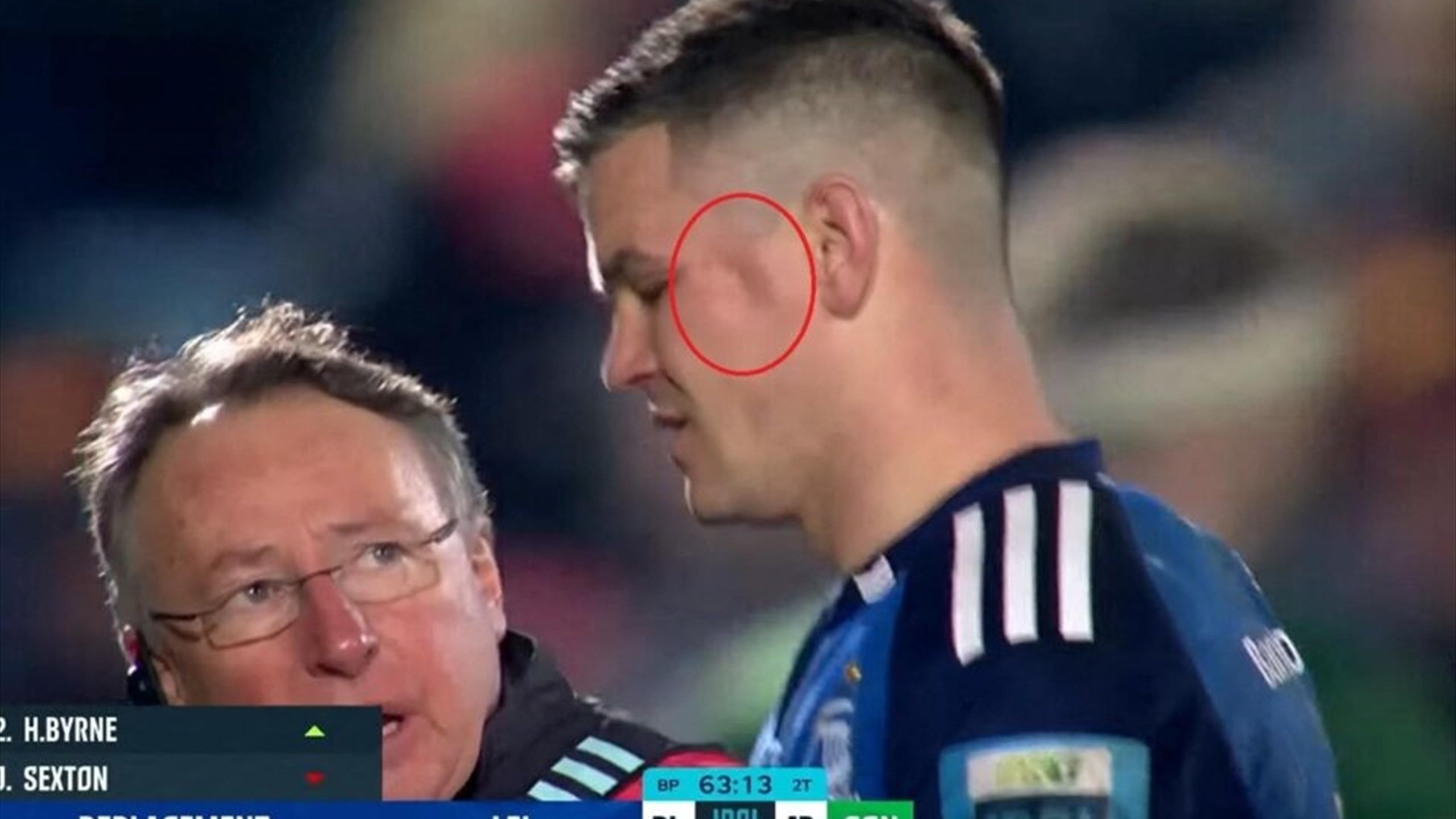 Blessure choquante pour Jonathan Sexton : L’inquiétude demeure !