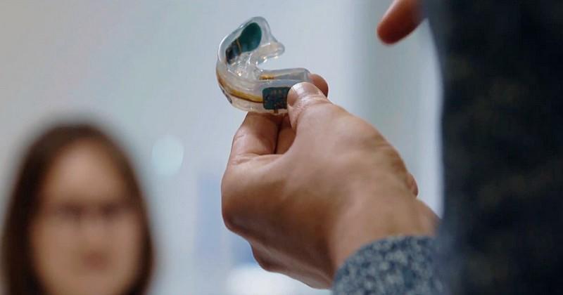 Les protège-dents connectés, le début d’un fiasco !